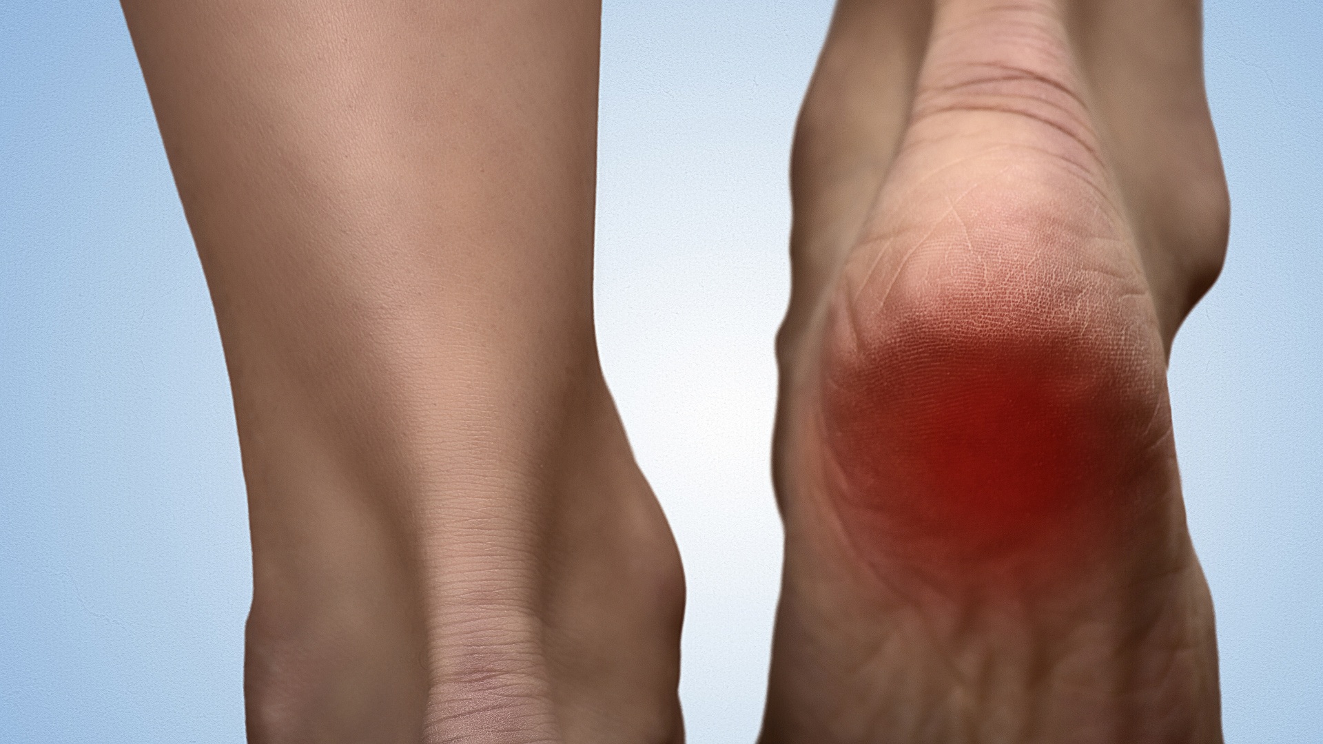 Patní ostruha: Úleva od bolesti a preventivní opatření