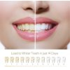 Gelové náplasti na bělení zubů 28 ks (14 parů)