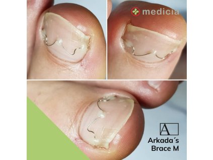 Kurz Medicia Arkada Brace M 1. stupeň 2