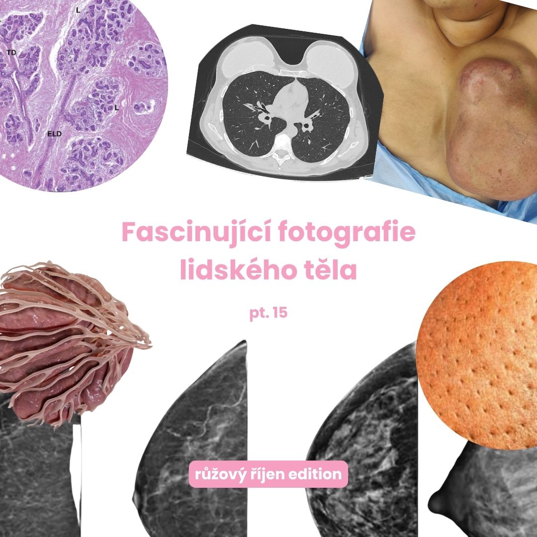 Fascinující fotografie lidského těla, růžový říjen speciál