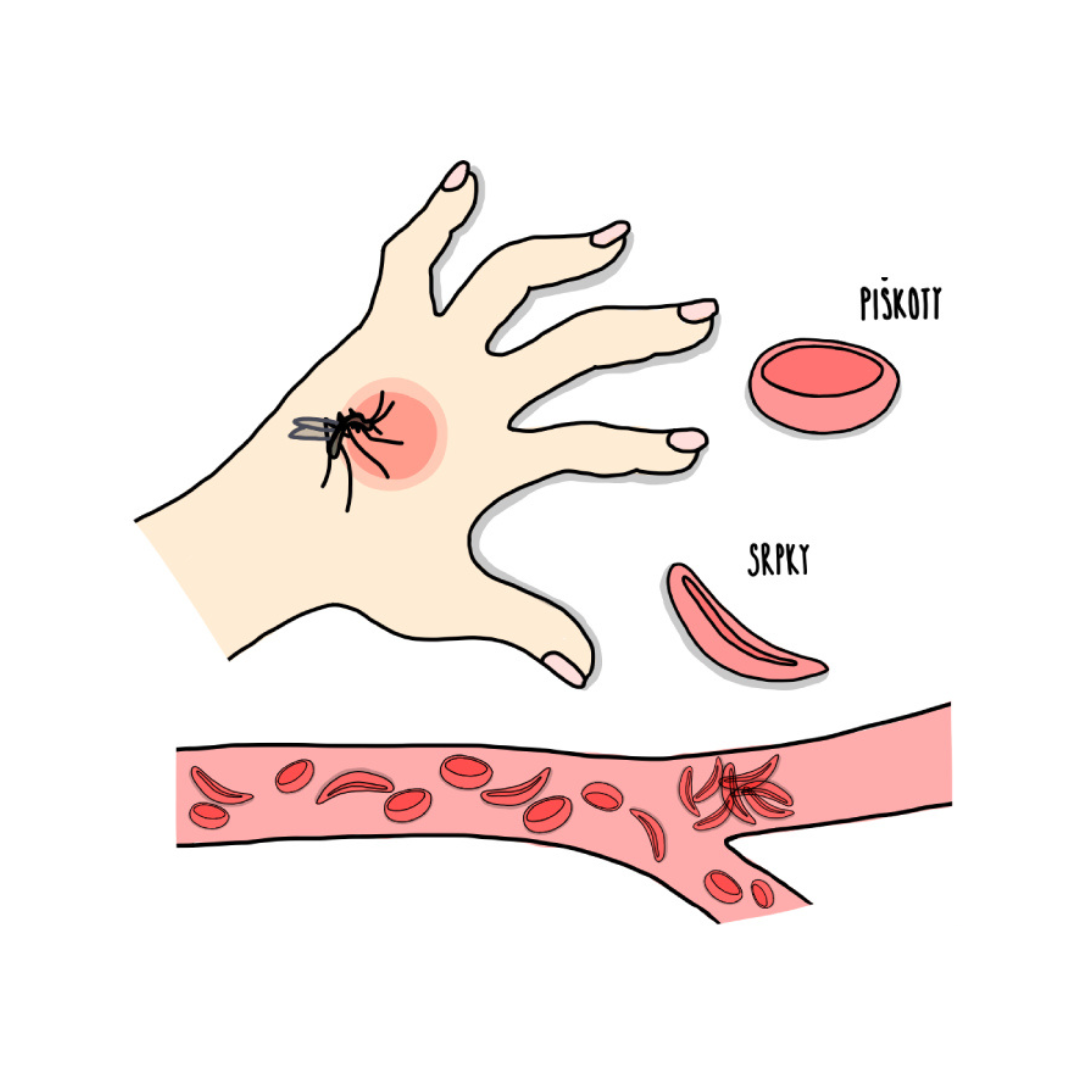 Co mají společného malárie a srpkovitá anémie?