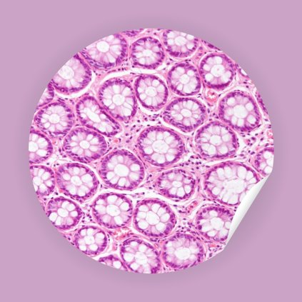 Naklejka Jelito grube