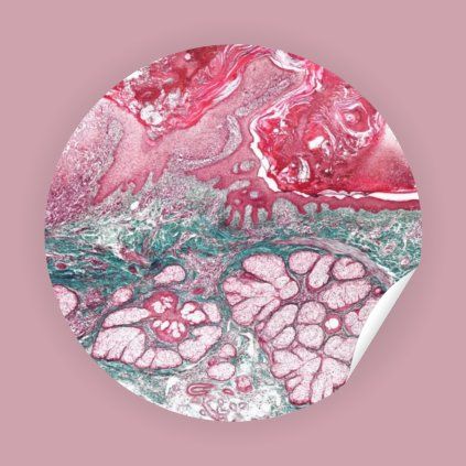 Sticker Skin
