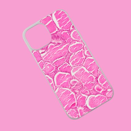 Etui na telefon komórkowy z tarczycą, białe