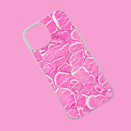 Etui na telefon Tarczyca białe