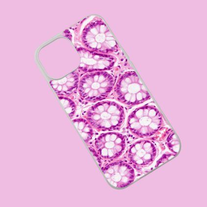 Phone case Intestine white