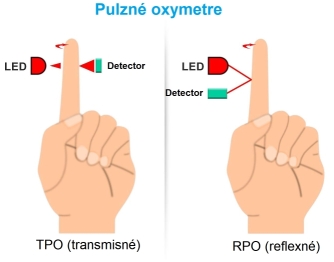 Reflexná sonda
