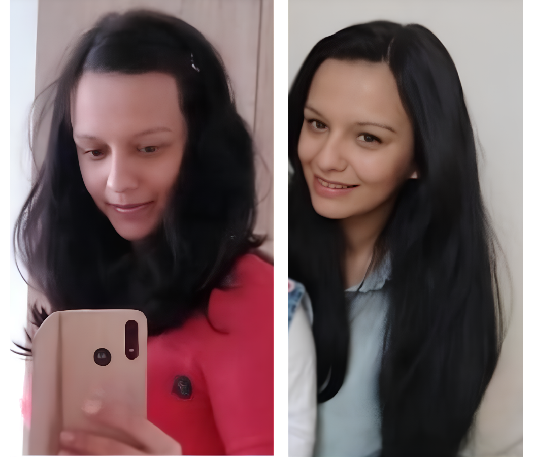 Výsledok zákazníčky po používaní Milva produktov