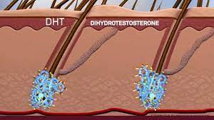 What is DHT Blocking?