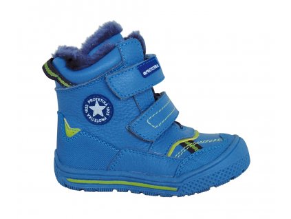 tod blue protetika zimne topanky