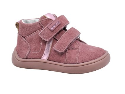 DARTA old pink topanky dievca protetika