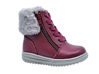 SISA protetika topanky dievca