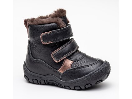 DAIRA zimna obuv dievca protetika