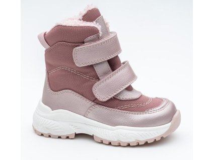 Mart pink zimna obuv dievca protetika