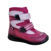 maron fuxia zimne detske topanky protetika