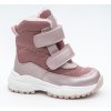 Mart pink zimna obuv dievca protetika