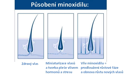 působení2