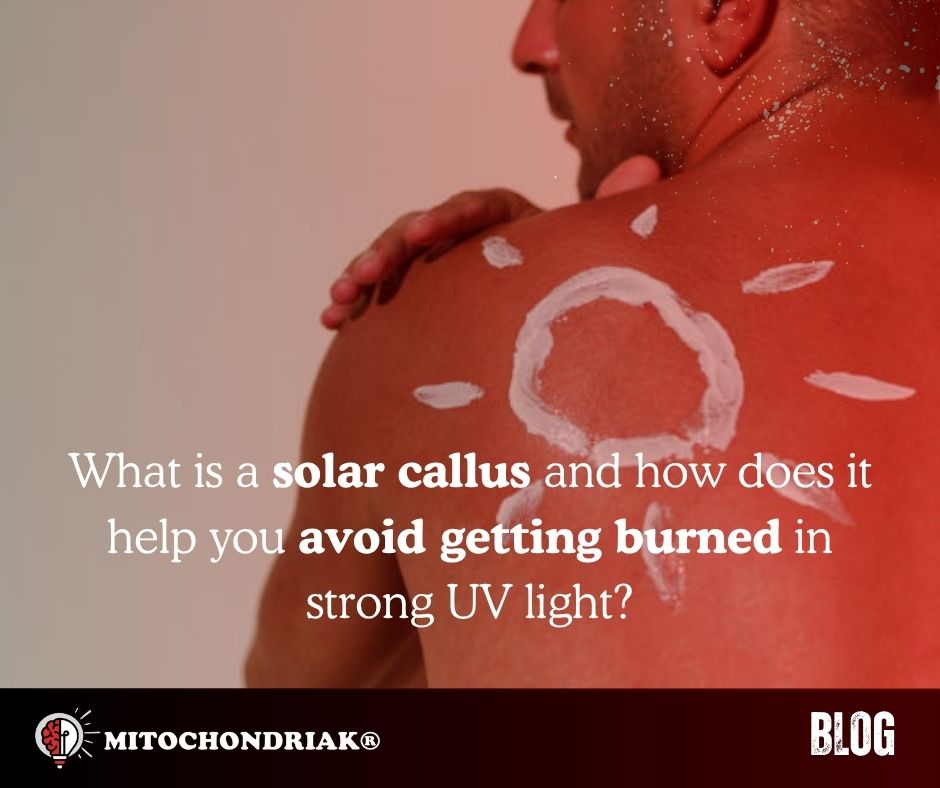 What is a solar callus and how does it help you avoid getting burned in the summer?