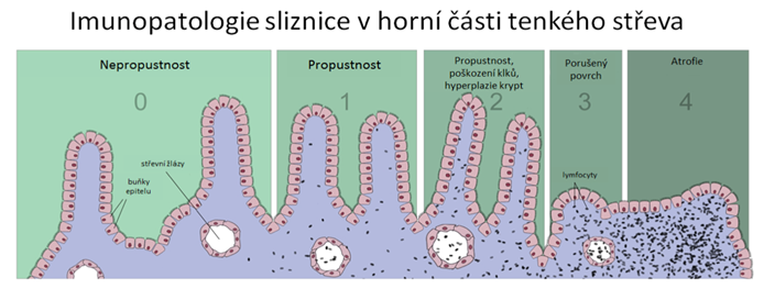 imunopatologie