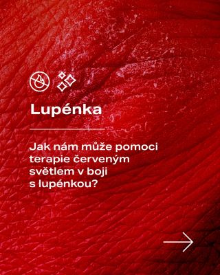 Lupénka dokáže výrazně zasáhnout do každodenního života. 🤕 Když ale člověk najde něco, co skutečně přináší úlevu, stojí to...