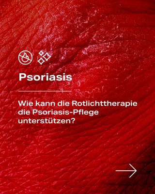 Psoriasis kann das tägliche Leben erheblich beeinträchtigen 🤕 Wenn man jedoch etwas findet, das spürbare Linderung...