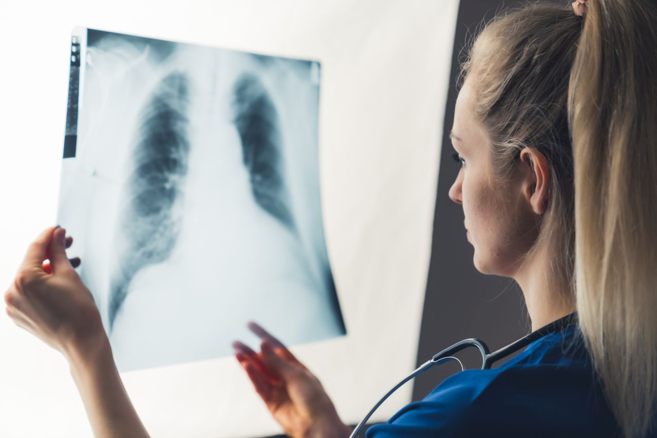Zápal plic - časté onemocnění v dětském věku