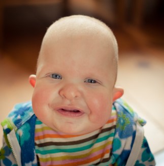 Co je Costello syndrom a jak ho léčit