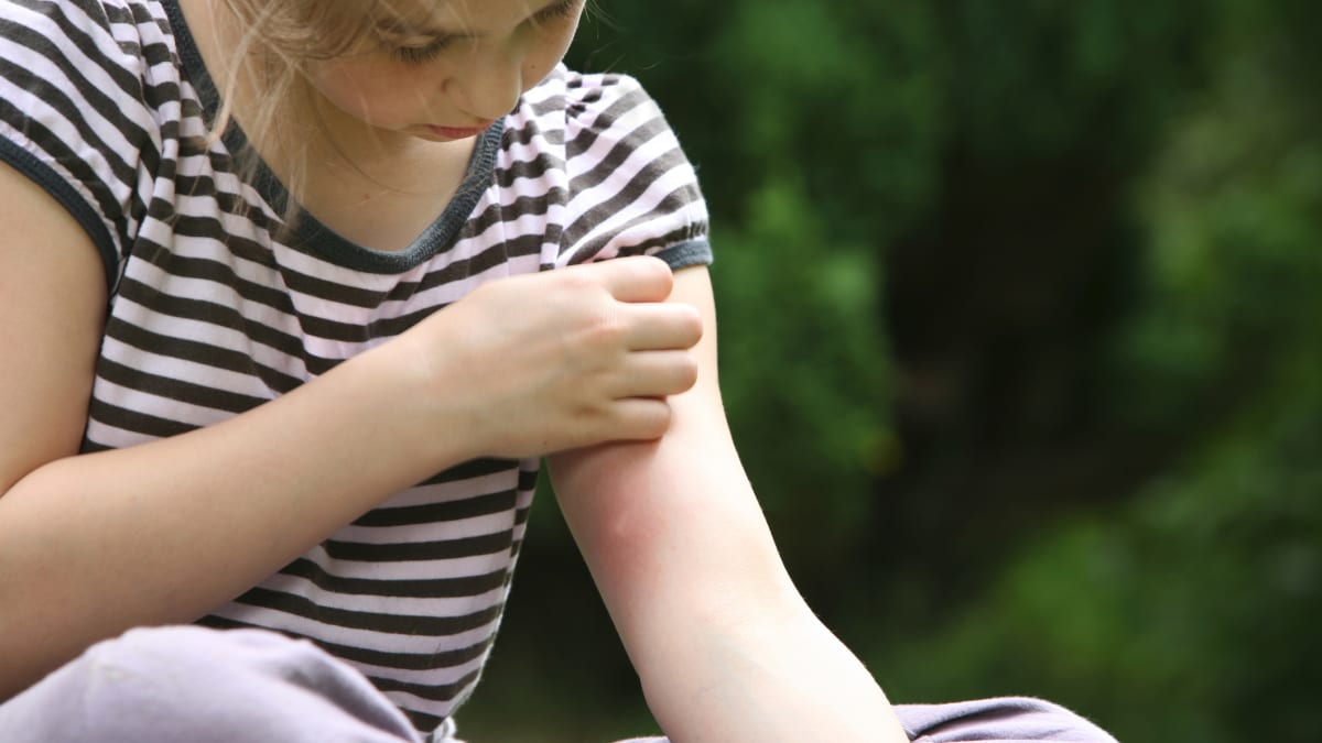 Jak na komáry: Účinné způsoby ochrany před hmyzem