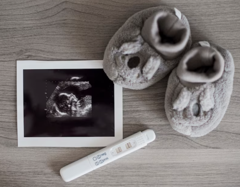 Císařský řez: Jak se na něj připravit