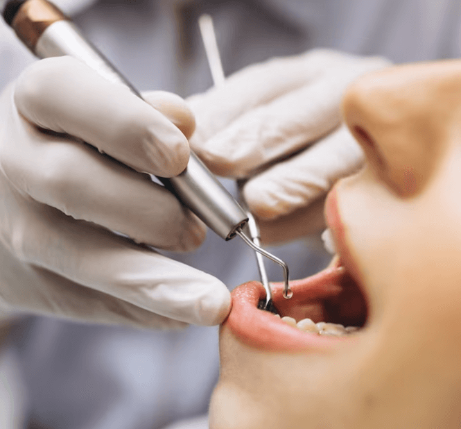 Výběr zubaře: Jak najít kvalitního a levného zubaře