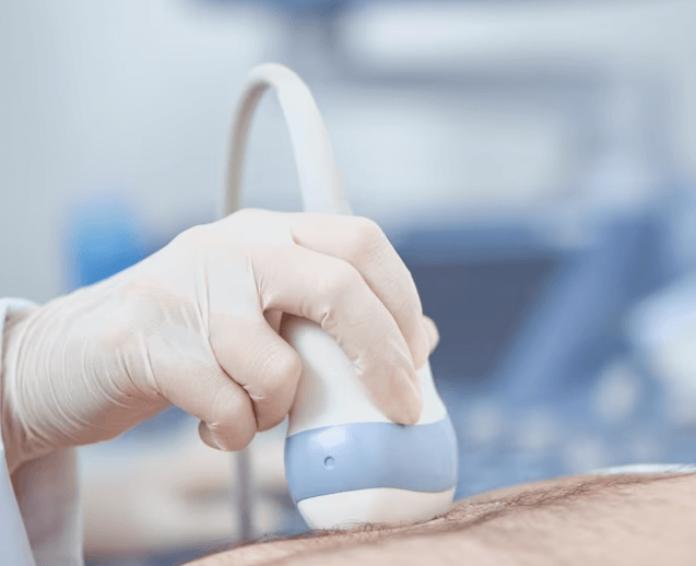 Sonografie: Co to je a kdy se provádí