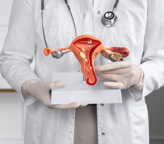 Co je to endometrióza a jak vzniká