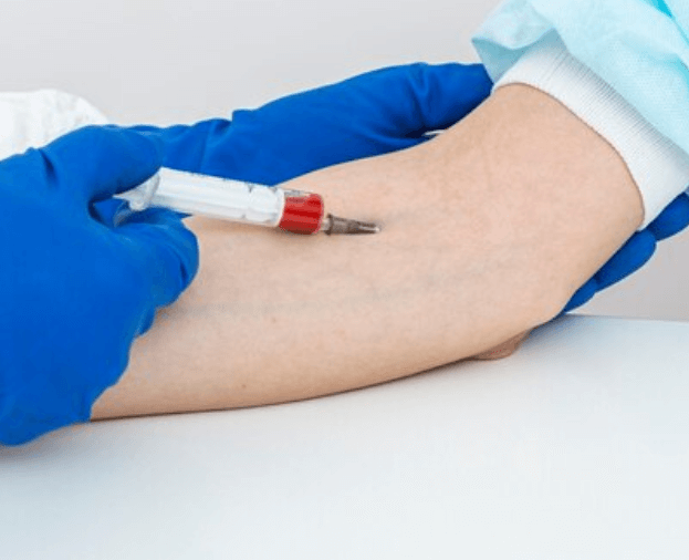 Co to je Leukopenie, Leukocytóza a Leukoplakie