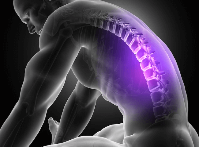 Co je diskopatie: Příčiny, příznaky a možnosti léčby