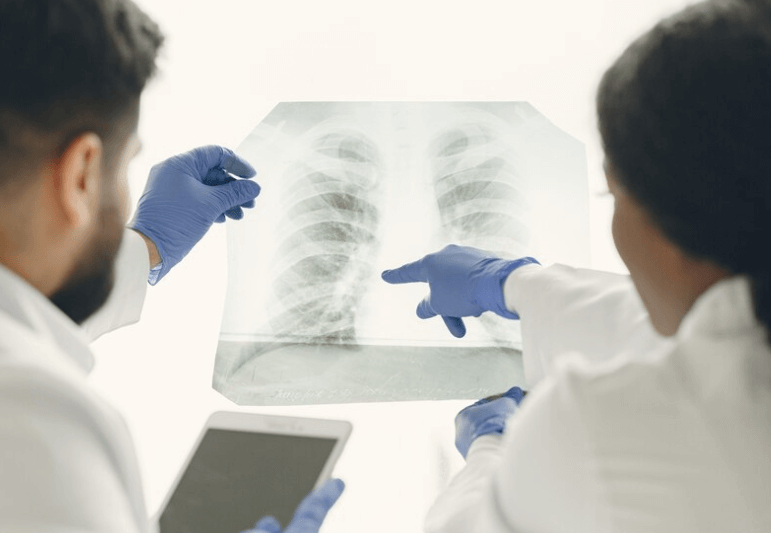 Co je pneumotorax: Příznaky, diagnostika a léčba