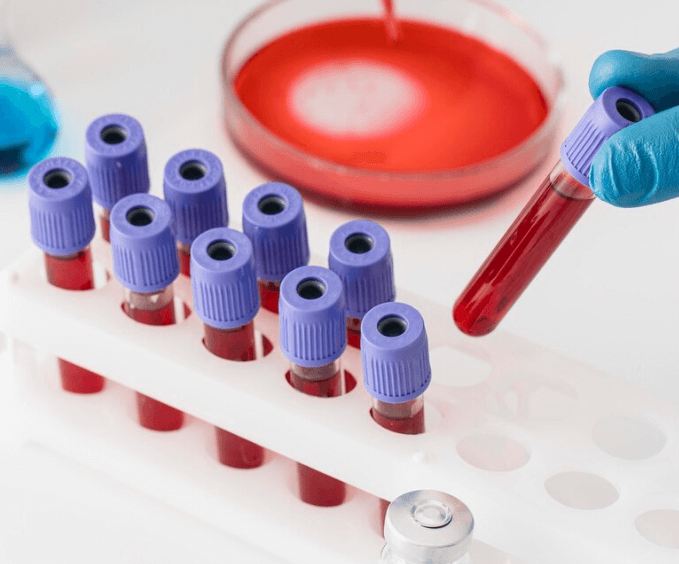 Jak zjistit krevní skupinu: Jednoduché způsoby