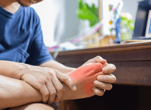 Jak léčit dnu: Prevence a management bolesti