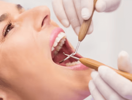 Jak odstranit zubní kámen: Domácí a lékařské metody