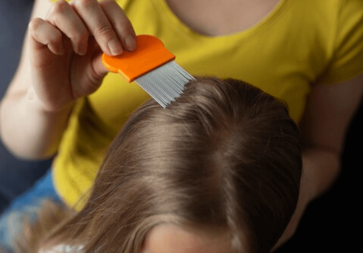 Jak poznat vši u dětí a zabránit šíření parazitů?