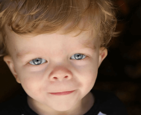 Co je Noonanův syndrom a jak se léčí