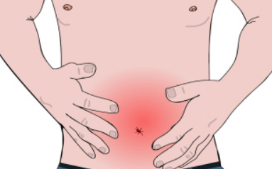 Co je Intususcepce a jak se léčí