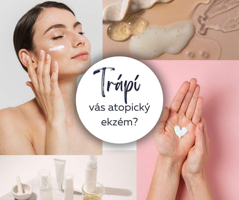 Sužuje vás atopický ekzém? Máme pro vás nový způsob řešení