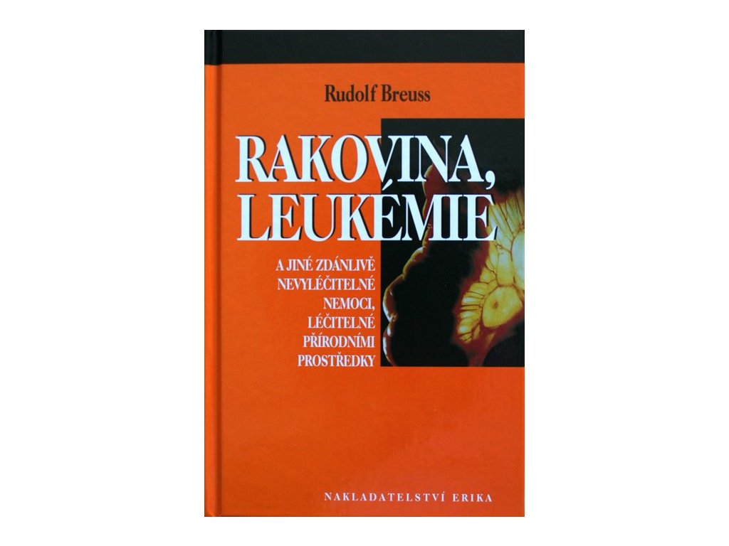 Rakovina, leukémie
