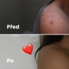 2298 4 c istici pe na 2