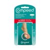 compeed naplast puchyr mala 6ks 83122 1966987 1000x1000 fit