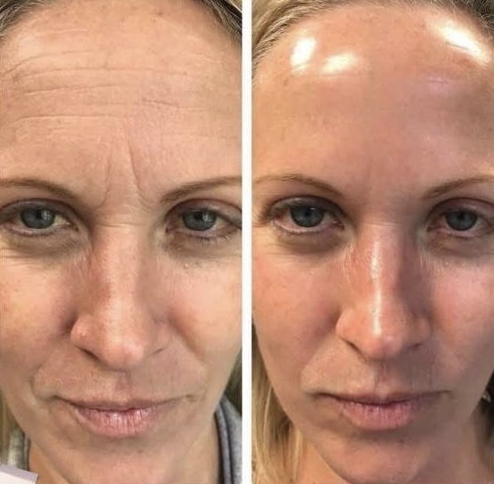 ageLOC Galvanic Spa sada