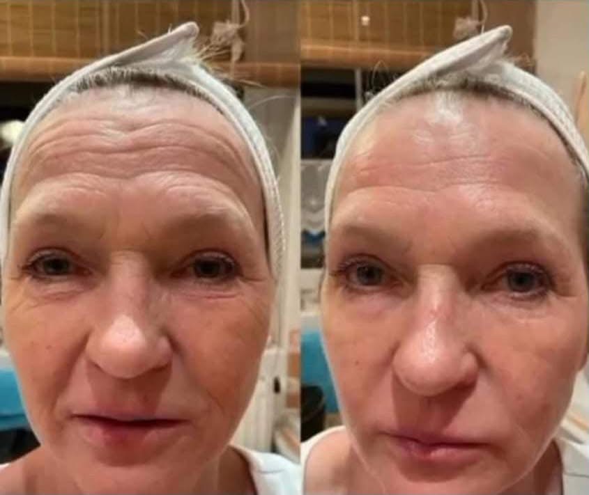 Galvanic Spa výsledok