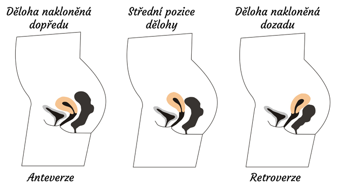 zaklonena-deloha