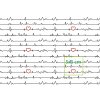 EKG červené srdíčko 12x5,7