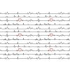 EKG červené srdíčko 12x5,7